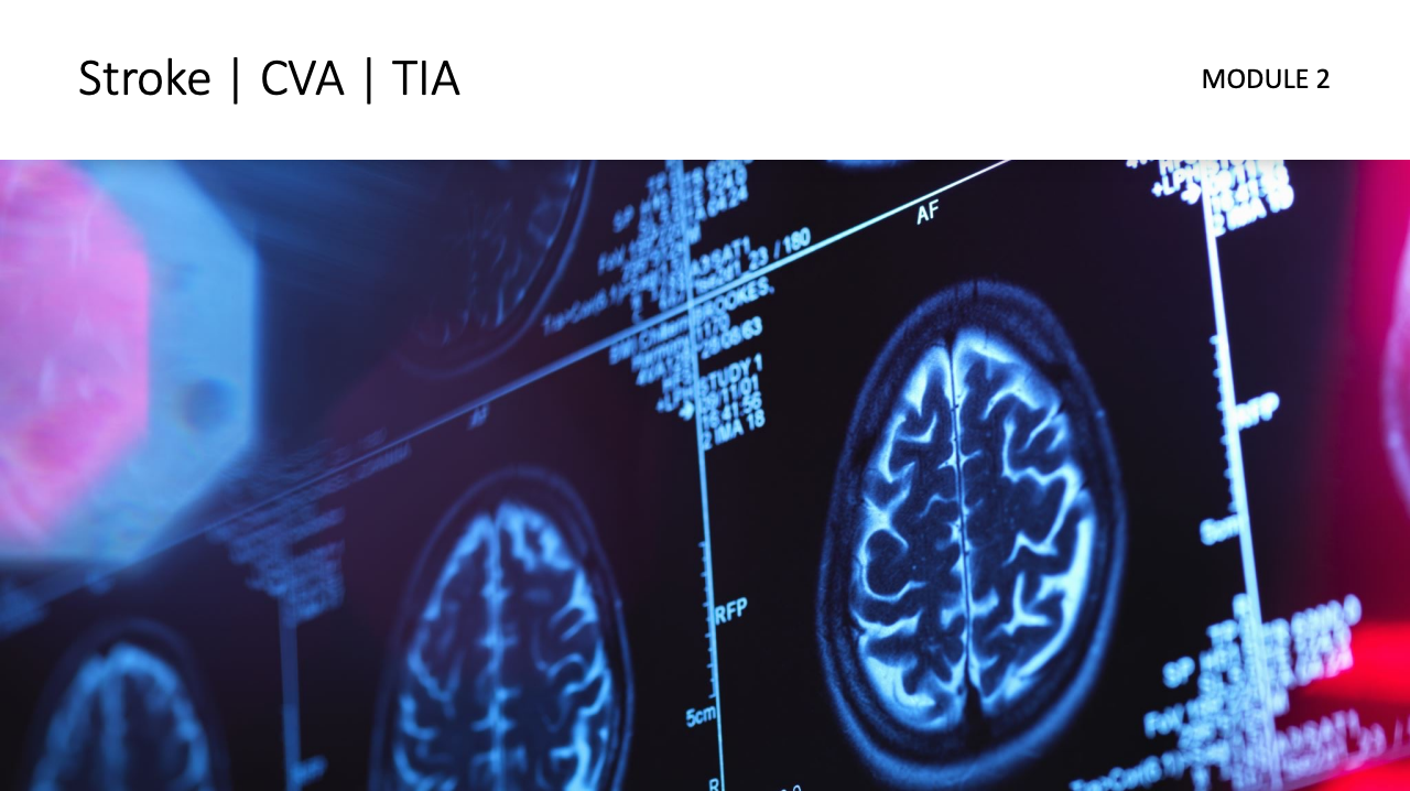 Module 2: Stroke | CVA | TIA